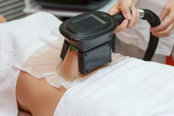 Image of person having fat freezing treatment to help weight gain Bedfordshire