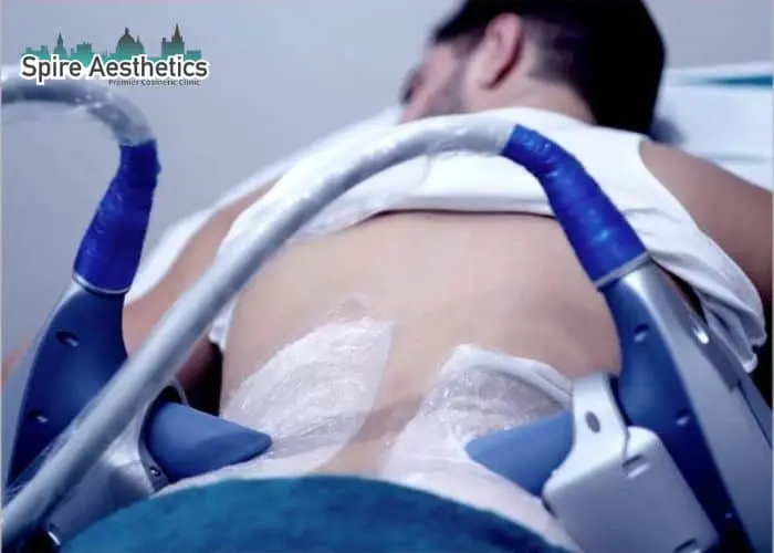 Man having fat freezing treatment done on love handles before a competitions Bedfordshire to create a sculpted look.