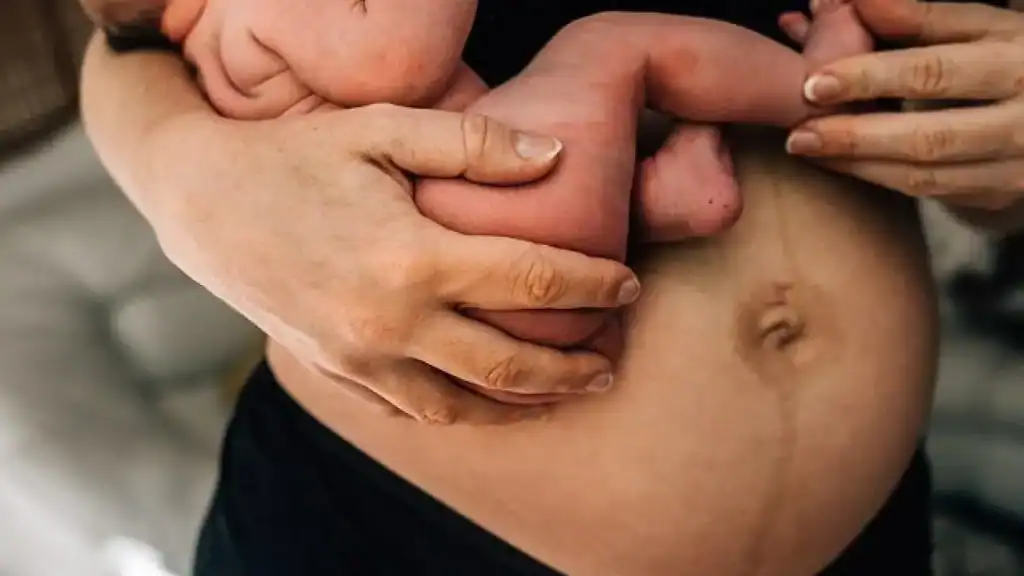 Why Is My Stomach Still Big After Pregnancy Bedfordshire?